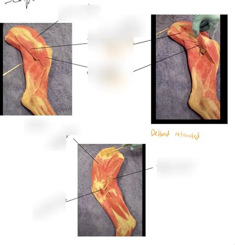 Scapular Muscle 的图像结果