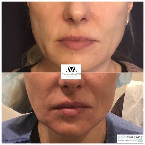 Image result for Face Threads