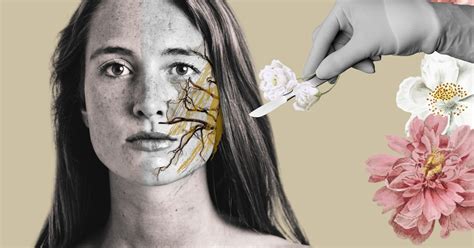 Mi vida antes y después de un espasmo hemifacial - La Tercera