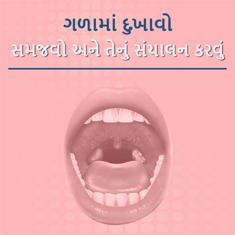 Sore Throat Management Tips in Gujarati | Causes, Remedies & Prevention