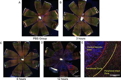 Image result for RPE Hexagonal Structure