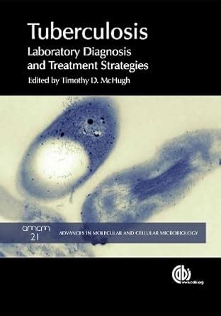 Buy Tuberculosis: Laboratory Diagnosis and Treatment Strategies: 21 ...