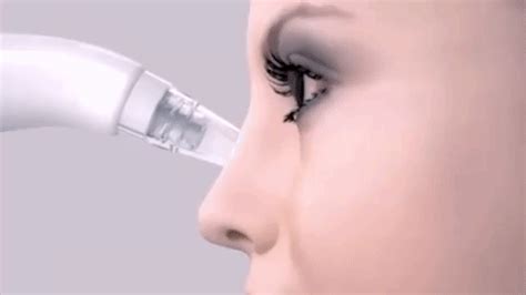 Vacuum Blackheads Remover – Dealcarto