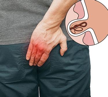 Pilonidal Sinus Treatment – Expert Surgical Care in Airoli | Krypton Clinic