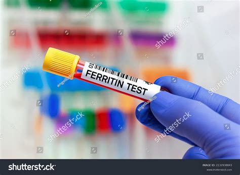 What Does Ferritin Look Like On A Blood Test at Karrie Keane blog