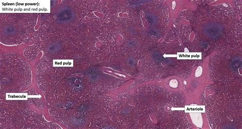 Spleen Histology White Pulp
