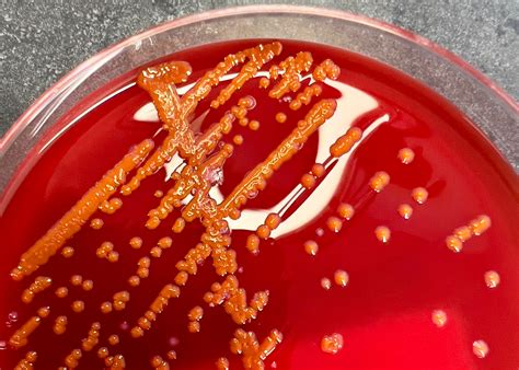 Serratia marcescens : r/microbiology