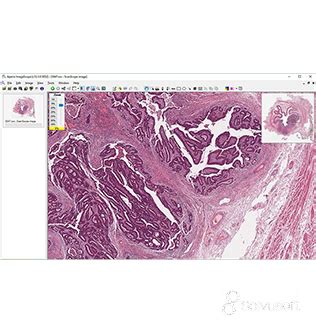 ImageScope Algorithm Software Logo 的图像结果