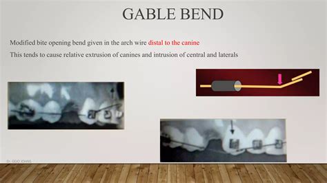 Intrusion mechanics in orthodontics | PPTX
