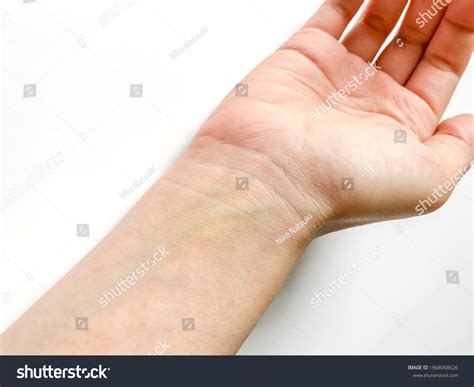 2,449 Wrist Vein Images, Stock Photos & Vectors | Shutterstock