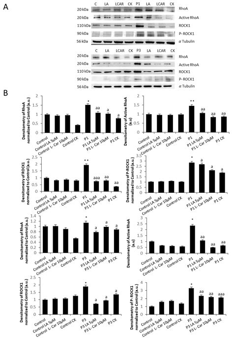 Actin Polymerization Defects Induce Mitochondrial Dysfunction in ...