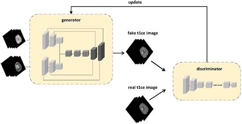 Frontiers | Multi-sequence generative adversarial network: better generation for enhanced ...