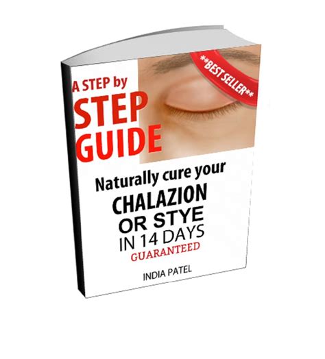 Step by step guide Naturally cure your chalazion or stye in 14 days ...