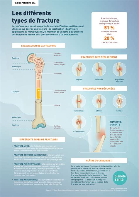 Les différents types de fracture | Revue Medicale Suisse