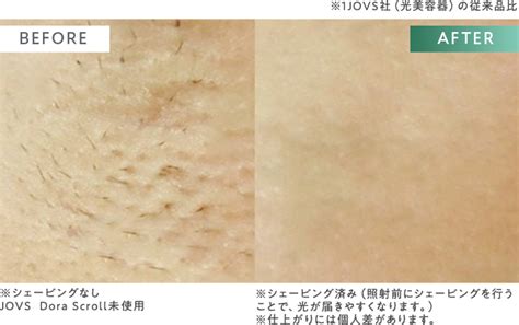 https://d2w53g1q050m78.cloudfront.net/jovsjapancom/uploads/dora/scroll/anim/about01_005.png