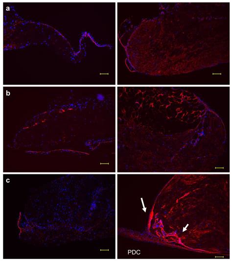 Roles of Two F-Box Proteins: FBXL14 in the Periosteum and FBXW2 at ...