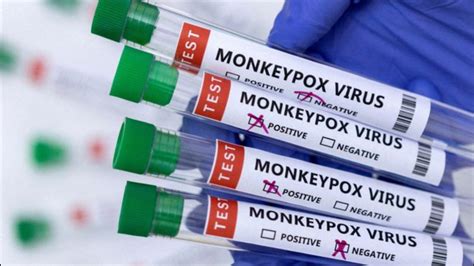 Monkeypox in India kerala a young man admitted to hospital in Kannur ...