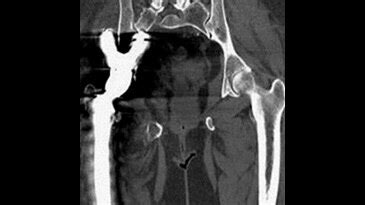 Image Gallery - Revolution HD - Computed Tomography - Products | GE ...