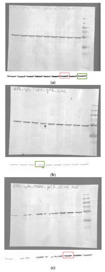 Potential Anti-Inflammatory and Chondroprotective Effect of Luzula ...