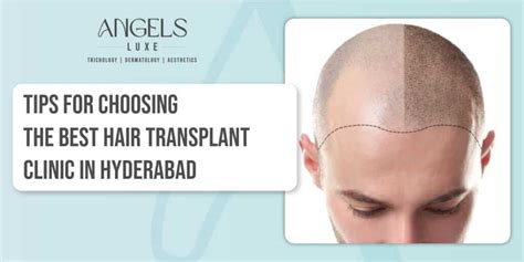 Best Hair & Skin Clinics in Gachibowli,Hyderabad|Angels Luxe