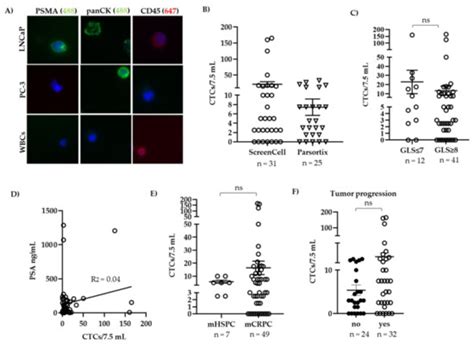 Biomedicines | Special Issue : Advanced Research in Prostate Cancer