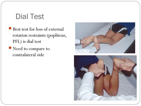Posterolateral corner injuries of knee joint | PPT