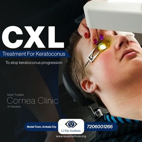 Keratoconus Treatment - LJ Eye Institute