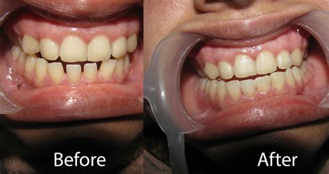 Prince Multispeciality Dental Clinic