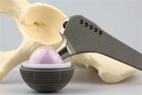 Hip Replacement Recovery Time Golf at Callie Ellis blog