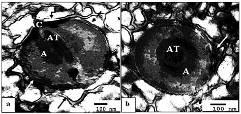 Morphometric, Histochemical, and Ultrastructural Analysis of the ...