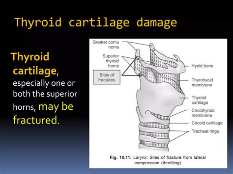 Image result for Post Strangulation