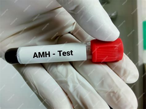 Premium Photo | Amh or anti mullerian hormone test