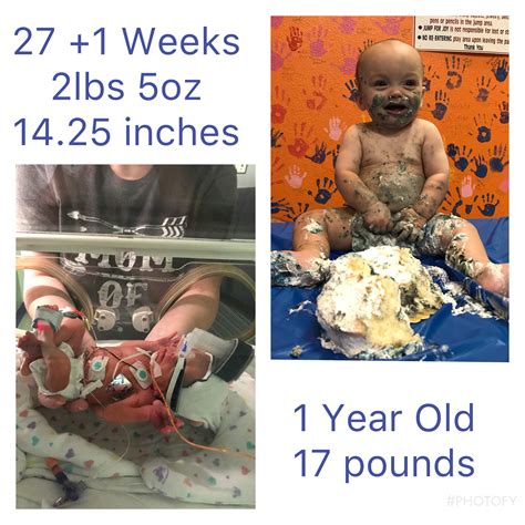 Premature Babies 27 Weeks