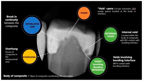 Prevalence and Characteristics of Radiographic Radiolucencies ...
