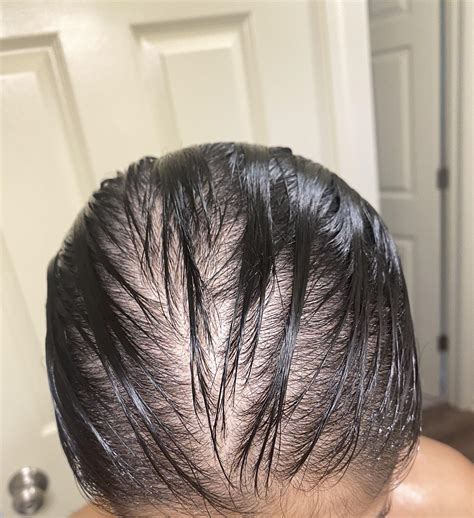 Hair Loss From Shower Water at Bruce Lohr blog