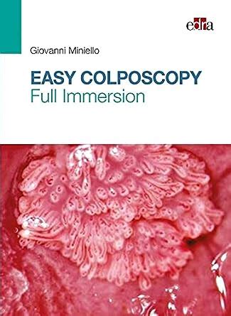 Buy Easy Colposcopy. Full Immersion: 500 Book Online at Low Prices in ...