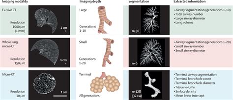 Small airway loss in the physiologically ageing lung: a cross-sectional study in unused donor ...