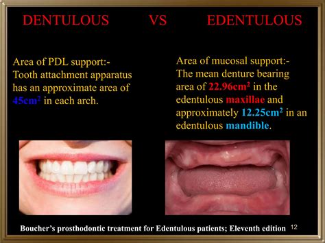 1. Biomechanics of edentulous state.pptx