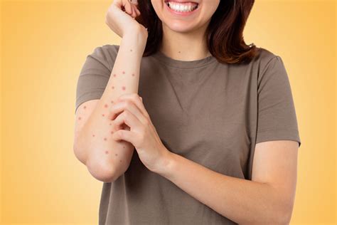 An expert’s guide on the causes, prevention and treatment for scabies
