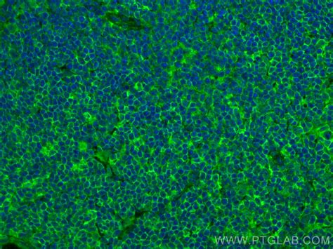 NOX2 antibody (82872-1-PBS) | Proteintech