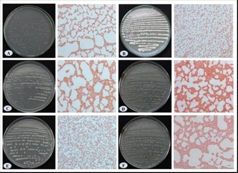 Govind Ballabh Pant National Institute of Himalayan Environment