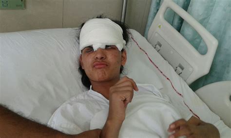 14YO Insha Malik Wanted To Be A Doctor. Today She's A Pellet Victim ...