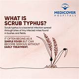 Beat Scrub Typhus: What Causes It and How to Protect Yourself