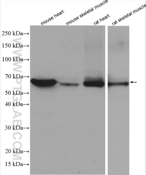 CRAT antibody (15170-1-AP) | Proteintech