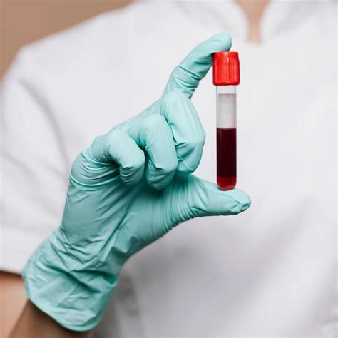 Intermittent Fasting and Blood Tests: How Fasting Affects Blood Test ...