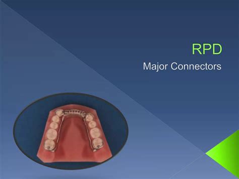 Major Connectors In Rpd Ppt at Amelie Coxen blog