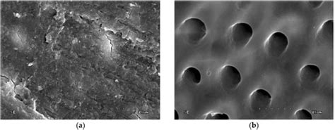 Dentine Surface Morphology after Chlorhexidine Application—SEM Study