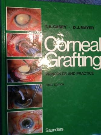 Buy Corneal Grafting Book Online at Low Prices in India | Corneal ...