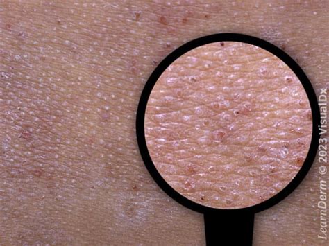Image result for Skin Tissue Texture Mapping