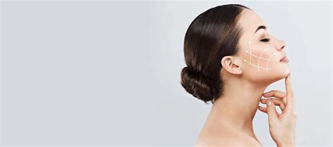 Image result for Spider Web Thread Lift Cost